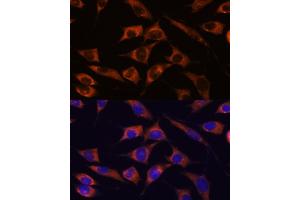 Immunofluorescence analysis of L929 cells using MMP25 antibody (ABIN7268422) at dilution of 1:100. (MMP25 antibody  (AA 350-540))