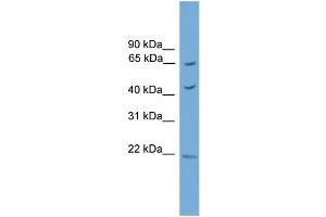 WB Suggested Anti-Tbx18 Antibody Titration:  0. (T-Box 18 antibody  (Middle Region))