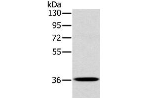 Western Blot analysis of A172 cell using CLP36 Polyclonal Antibody at dilution of 1:400 (PDLIM1 antibody)