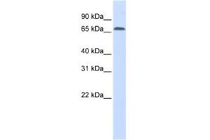 WB Suggested Anti-IRF2BP1 Antibody Titration: 0. (IRF2BP1 antibody  (Middle Region))
