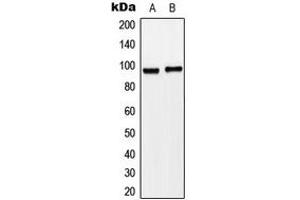 Western blot analysis of Matriptase expression in HeLa (A), SW620 (B) whole cell lysates.