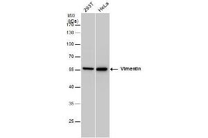 WB Image Vimentin antibody detects Vimentin protein by western blot analysis. (Vimentin antibody)