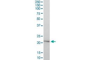 HYAL1 MaxPab polyclonal antibody. (HYAL1 antibody  (AA 1-253))
