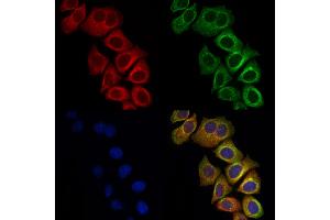 ABIN6261515 and ABIN6278456 staining Hela cells by IF/ICC. (ELMO1 antibody  (C-Term))