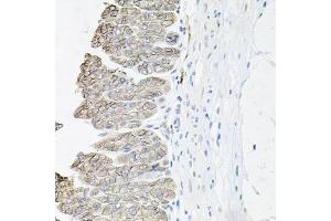 Immunohistochemistry of paraffin-embedded mouse stomach using B1 antibody (ABIN6127389, ABIN6137306, ABIN6137309 and ABIN6221475) at dilution of 1:100 (40x lens). (ATP1B1 antibody  (AA 63-303))