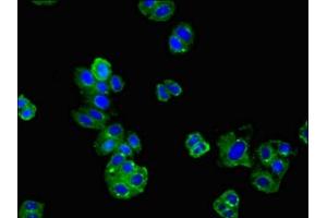 Immunofluorescent analysis of HepG2 cells using ABIN7173980 at dilution of 1:100 and Alexa Fluor 488-congugated AffiniPure Goat Anti-Rabbit IgG(H+L) (Angiotensin II Type-1 Receptor antibody  (AA 306-356))