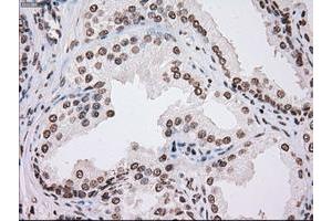 Image no. 3 for anti-TYRO3 Protein Tyrosine Kinase (TYRO3) antibody (ABIN1501607)