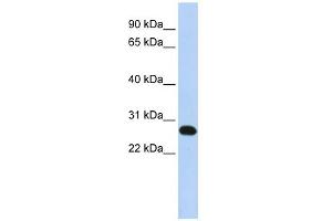 WB Suggested Anti-FAM119A Antibody Titration: 0. (FAM119A antibody  (N-Term))
