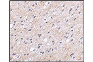 Immunohistochemical staining of human brain tissue using AP30597PU-N at 2. (NIPSNAP1 antibody  (Center))