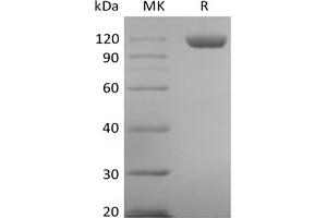 Western Blotting (WB) image for TEK Tyrosine Kinase, Endothelial (TEK) protein (His tag) (ABIN7319884)