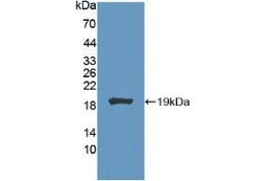Western blot analysis of recombinant Mouse CA7.