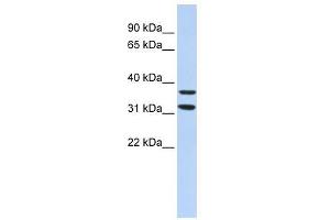 ZNF254 antibody used at 1.