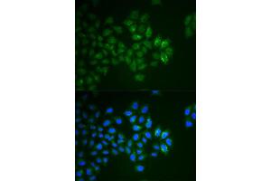 Immunofluorescence analysis of HeLa cell using SYT1 antibody. (SYT1 antibody)