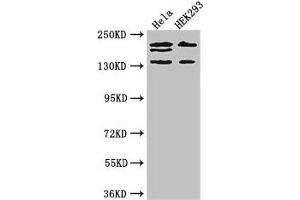 Western Blot Positive WB detected in: Hela whole cell lysate, HEK293 whole cell lysate All lanes: ITSN2 antibody at 4 μg/mL Secondary Goat polyclonal to rabbit IgG at 1/50000 dilution Predicted band size: 194, 191, 142, 136 kDa Observed band size: 194, 191, 142 kDa (Intersectin 2 antibody  (AA 940-1209))