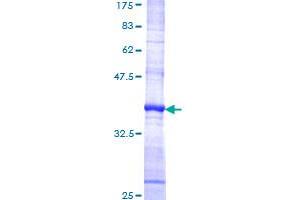 Image no. 1 for Chemokine (C Motif) Ligand 1 (XCL1) (AA 22-114) protein (GST tag) (ABIN1325429)