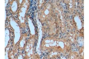 Immunohistochemistry (IHC) image for anti-Apolipoprotein A-I (APOA1) (AA 25-265) antibody (ABIN7427357)