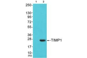 Western Blotting (WB) image for anti-TIMP Metallopeptidase Inhibitor 1 (TIMP1) (Internal Region) antibody (ABIN1848806) (TIMP1 antibody  (Internal Region))