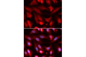 Immunofluorescence analysis of U2OS cells using SMAD4 antibody (ABIN5973302). (SMAD4 antibody)
