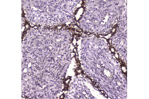 IHC analysis of Glutathione Reductase using anti-Glutathione Reductase antibody . (Glutathione Reductase antibody  (AA 256-522))
