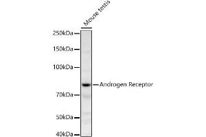 Western blot analysis of extracts of Mouse testis, using Androgen Receptor antibody (ABIN3022797, ABIN3022798, ABIN3022799 and ABIN6219233) at 1:668 dilution. (Androgen Receptor antibody)