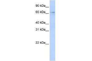 WB Suggested Anti-A1CF Antibody Titration:  0. (A1CF antibody  (N-Term))