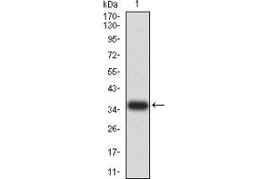 Western blot analysis using PAK3 mAb against human PAK3 (AA: 1-100) recombinant protein.