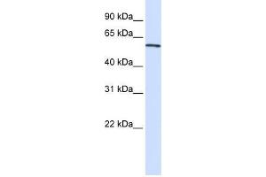 Transfected 293T; WB Suggested Anti-ALAS2 Antibody Titration: 0. (ALAS2 antibody  (C-Term))