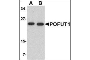 Western blot analysis of POFUT1 in human heart tissue lysate with this product at (A) 0.