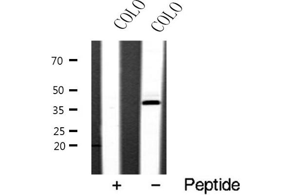 SIAH2 antibody  (C-Term)