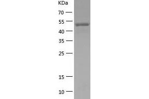 Western Blotting (WB) image for Zinc Finger and BTB Domain Containing 9 (ZBTB9) (AA 1-473) protein (His tag) (ABIN7288276) (ZBTB9 Protein (AA 1-473) (His tag))