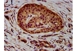 Immunohistochemistry (IHC) image for anti-ADAM Metallopeptidase Domain 23 (Adam23) (AA 498-647) antibody (ABIN7150047)