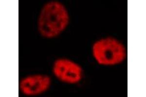 ABIN6272401 staining HeLa by IF/ICC. (PRPF31 antibody  (Internal Region))