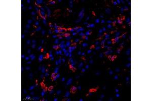 Immunofluorescence of paraffin embedded human kidney using KCTD19 (ABIN7075147) at dilution of 1: 500 (450x lens) (KCTD19 antibody)