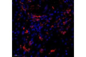 Immunofluorescence of paraffin embedded human kidney using KCTD19 (ABIN7075147) at dilution of 1: 500 (450x lens) (KCTD19 antibody)