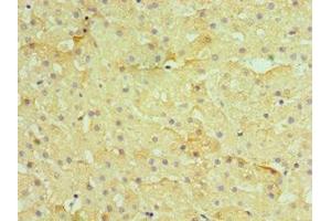 Immunohistochemistry of paraffin-embedded human liver tissue using ABIN7155385 at dilution of 1:100 (H2AFZ antibody  (AA 1-128))