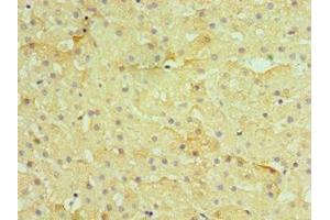 Immunohistochemistry of paraffin-embedded human liver tissue using ABIN7155385 at dilution of 1:100