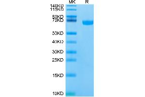 Biotinylated Human/Cynomolgus/Rhesus macaque ROR1 on Tris-Bis PAGE under reduced condition. (ROR1 Protein (His-Avi Tag,Biotin))