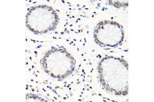 Immunohistochemistry of paraffin-embedded human colon using MonoMethyl-Histone H4-R3 antibody (ABIN1680263, ABIN1680264, ABIN6220110 and ABIN6220114) at dilution of 1:100 (40x lens). (Histone H4 antibody  (meArg3))