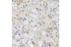 Immunohistochemistry of paraffin-embedded rat brain using ACTR2 antibody (ABIN2560930) at dilution of 1:100 (40x lens). (ACTR2 antibody)