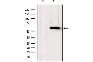 Western blot analysis of extracts from various samples, using PHGDH antibody.
