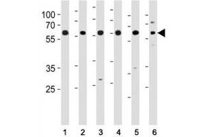 HDAC1 antibody western blot analysis of (1) HeLa, (2) K562, (3) mouse NIH3T3 cell line and (4) mouse testis, (5) rat testis and (6) rat spleen tissue lysate. (HDAC1 antibody  (AA 1-30))