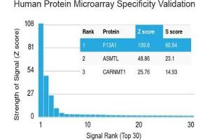 Analysis of HuProt(TM) microarray containing more than 19,000 full-length human proteins using Factor XIIIa antibody (clone F13A1/1683). (F13A1 antibody  (AA 46-181))