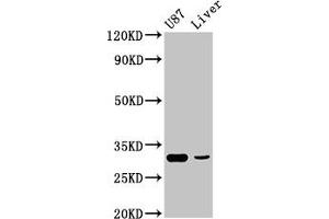 Western Blot Positive WB detected in: U87 whole cell lysate, Rat liver tissue All lanes: ITM2B antibody at 4.