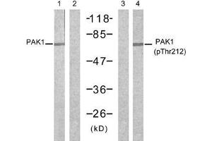 Western blot analysis of extracts from 293 cells, untreated or treated with forskolin (40µM, 30min), using PAK1 (Ab-212) antibody (E021160, Lane 1 and 2) and PAK1 (phospho-Thr212) antibody (E011154, Lane 3 and 4). (PAK1 antibody)
