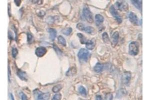 Immunohistochemical staining of formalin-fixed paraffin-embedded human skin tissue with ADAMTS2 polyclonal antibody  at 1 : 200 dilution. (Adamts2 antibody  (C-Term))