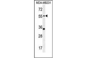 Western blot analysis of PDE12 Antibody (C-term) in MDA-MB231 cell line lysates (35ug/lane).