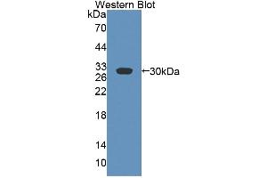 Figure. (ABCB4 antibody  (AA 1034-1276))