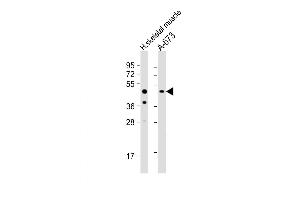 Western Blot at 1:1000 dilution Lane 1: human skeletal muscle lysate Lane 2: A-673 whole cell lysate Lysates/proteins at 20 ug per lane. (UHMK1 antibody  (C-Term))