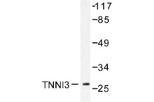 Image no. 1 for anti-Cardiac Troponin I (TNNI3) antibody (ABIN271939) (TNNI3 antibody)