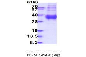 Fc Fragment of IgA, Receptor For (FCAR) (AA 22-227) protein (His tag)